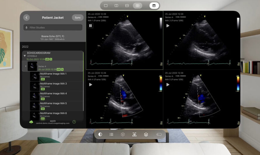 Apple Vision Pro unlocks new opportunities for health app developers